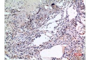 Immunohistochemistry (IHC) analysis of paraffin-embedded Human Lung, antibody was diluted at 1:100. (MCM7 antibody  (Internal Region))