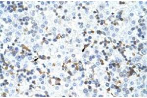 Immunohistochemical staining (Formalin-fixed paraffin-embedded sections) of human liver with CPSF3 polyclonal antibody  at 4-8 ug/mL working concentration.