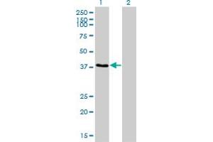 Western Blot analysis of RNF14 expression in transfected 293T cell line by RNF14 monoclonal antibody (M01), clone 4G9.