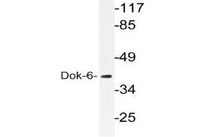 Western blot (WB) analysis of Dok-6 pAb in extracts from COLO205 cells.