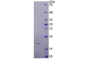 Rabbit Detection antibody from the kit in WB with Positive Control:  Sample Human Kidney lysate. (FABP4 ELISA Kit)