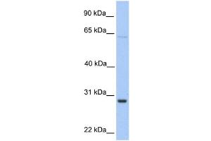 WB Suggested Anti-HPRT1 Antibody Titration:  0. (HPRT1 antibody  (Middle Region))