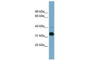 METAP1 antibody used at 1 ug/ml to detect target protein. (METAP1 antibody  (N-Term))