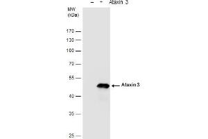 WB Image Ataxin 3 antibody detects Ataxin 3 protein by western blot analysis.