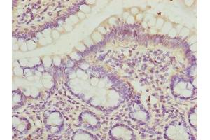 Immunohistochemistry of paraffin-embedded human small intestine tissue using ABIN7150894 at dilution of 1:100 (DYNLRB1 antibody  (AA 3-96))