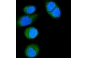 IF analysis of CD14 using anti-CD14 antibody (ABIN7600531). (CD14 antibody  (AA 20-259))