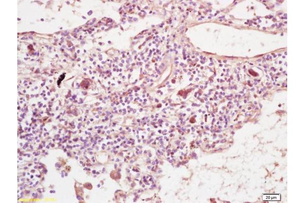 PLEKHM2 antibody  (AA 688-750)
