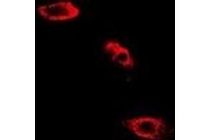 Immunofluorescent analysis of SHMT2 staining in HepG2 cells. (SHMT2 antibody)