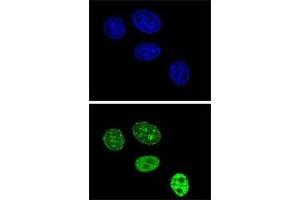Confocal immunofluorescent analysis of PCNA antibody with HeLa cells followed by Alexa Fluor 488-conjugated goat anti-rabbit lgG (green). (PCNA antibody  (AA 231-261))