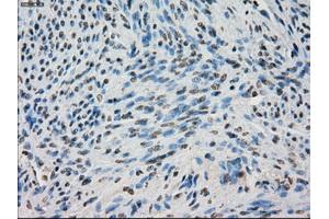 Immunohistochemical staining of paraffin-embedded Ovary tissue using anti-BUB1Bmouse monoclonal antibody. (BUB1B antibody)