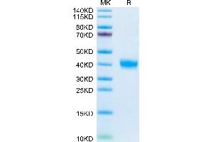 Mouse PRLR on Tris-Bis PAGE under reduced condition. (Prolactin Receptor Protein (PRLR) (AA 20-229) (His tag))