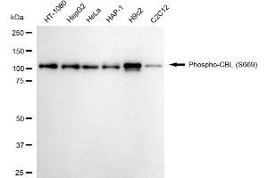 Western blotting analysis using phospho-CBL (S669) antibody (ABIN7797879).
