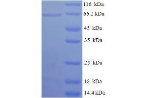 SDS-PAGE (SDS) image for Succinate Dehydrogenase Complex, Subunit D, Integral Membrane Protein (SDHD) (AA 1-440), (full length) protein (His-SUMO Tag) (ABIN4977034) (SDHD Protein (AA 1-440, full length) (His-SUMO Tag))