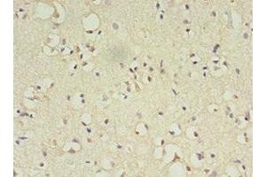 Immunohistochemistry of paraffin-embedded human brain tissue using ABIN7144817 at dilution of 1:100 (ATL3 antibody  (AA 1-187))