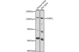 Western blot analysis of extracts of various cell lines, using P antibody  at 1:1000 dilution. (PARP1 antibody)