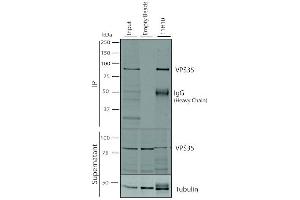 Immunoprecipitation (IP) image for anti-Vacuolar Protein Sorting 35 (VPS35) antibody (Atto 488) (ABIN6933006)