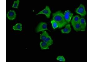 Immunofluorescence staining of MCF-7 cells with ABIN7168912 at 1:133, counter-stained with DAPI.