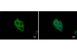 ICC/IF Image NOX1 antibody detects NOX1 protein at cytoplasm by immunofluorescent analysis. (NOX1 antibody)