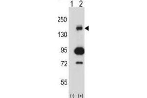 Western Blotting (WB) image for anti-Mitogen-Activated Protein Kinase Kinase Kinase 5 (MAP3K5) antibody (ABIN2997990)