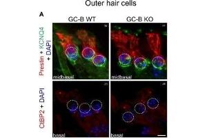 No change in inner hair cell (IHC) or outer hair cell (OHC) phenotype or reduction in numbers of afferent synaptic contacts with OHCs or IHCs was observed in GC-B KO mice. (KCNQ4 antibody  (AA 2-77))