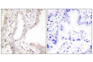 Immunohistochemistry (IHC) image for anti-PRKC, Apoptosis, WT1, Regulator (PAWR) (C-Term) antibody (ABIN1848751) (PAWR antibody  (C-Term))
