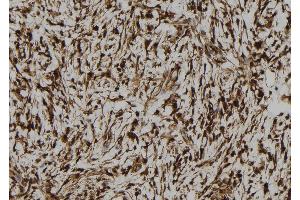 ABIN6273105 at 1/100 staining Human gastric tissue by IHC-P. (CREB3L1 antibody  (N-Term))