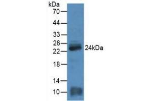 Figure. (MYL4 antibody  (AA 4-187))