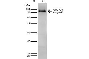 Western Blot analysis of Rat Brain showing detection of ~200 kDa Ankyrin-R protein using Mouse Anti-Ankyrin-R Monoclonal Antibody, Clone S388A-10 . (Erythrocyte Ankyrin antibody  (AA 1-1881) (Atto 488))