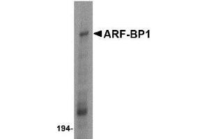 Western blot analysis of ARF-BP1 in Daudi cell lysate with ARF-BP1 antibody at 1 μg/ml. (HUWE1 antibody  (C-Term))