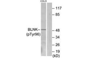 Western blot analysis of extracts from COLO205 cells, using BLNK (Phospho-Tyr96) Antibody. (B-Cell Linker antibody  (pTyr96))