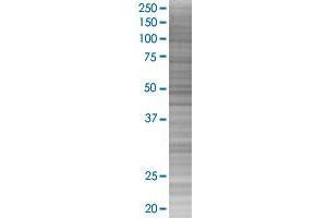 PPP2R2B transfected lysate. (PPP2R2B 293T Cell Transient Overexpression Lysate(Denatured))