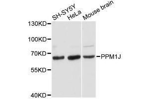 Western blot analysis of extracts of various cell lines, using PPM1J antibody. (PPM1J antibody)