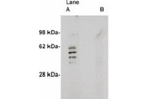 Image no. 1 for anti-Sphingomyelin Synthase 2 (SGMS2) antibody (ABIN4620351) (Sphingomyelin Synthase 2 antibody)