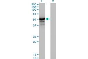Western Blotting (WB) image for anti-Homocysteine-Inducible, Endoplasmic Reticulum Stress-Inducible, Ubiquitin-Like Domain Member 1 (HERPUD1) (AA 74-181) antibody (ABIN466153) (HERPUD1 antibody  (AA 74-181))