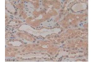 IHC-P analysis of Human Kidney Tissue, with DAB staining. (NUP210 antibody  (AA 1288-1449))