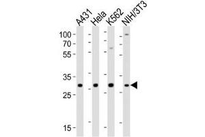 Western blot analysis of lysate from A431, HeLa, K562, mouse NIH3T3 cell line using CDK5 antibody