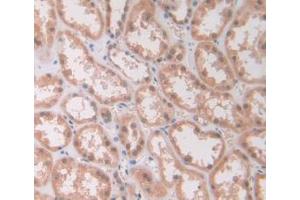 DAB staining on IHC-P; Samples: Human Kidney Tissue (IL12A antibody  (AA 23-219))