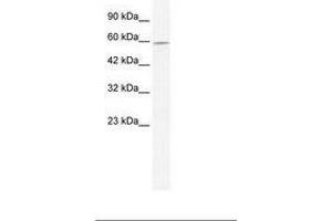 Image no. 1 for anti-DEAD (Asp-Glu-Ala-Asp) Box Polypeptide 47 (DDX47) (AA 41-90) antibody (ABIN203145) (DDX47 antibody  (AA 41-90))
