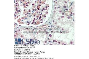 Immunohistochemistry (IHC) image for anti-T-Box 20 (TBX20) (N-Term) antibody (ABIN182755) (TBX20 antibody  (N-Term))