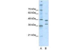 WB Suggested Anti-SMARCB1  Antibody Titration: 0. (SMARCB1 antibody  (Middle Region))