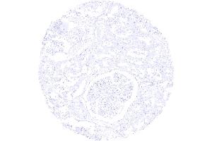 Kidney cortex S100P immunostaining is completely lacking in the kidney (Recombinant S100P antibody  (C-Term))