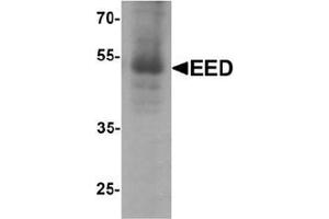Western blot analysis of EED in human heart tissue lysate with EED Antibody  at 1 μg/ml. (EED antibody  (N-Term))