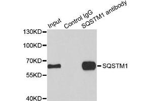 Immunoprecipitation analysis of 100 μg extracts of HepG2 cells using 3 μg SQSTM1 antibody (ABIN5998960). (SQSTM1 antibody)