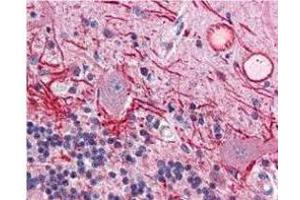 Immunohistochemistry of Mouse anti-AKT pT308 antibody.