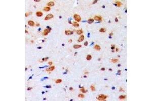 Immunohistochemical analysis of AKT (pY315) staining in human brain formalin fixed paraffin embedded tissue section. (AKT1 antibody  (pTyr315))