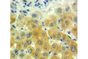 IHC-P analysis of Liver tissue, with DAB staining. (GDF7 antibody  (AA 295-447))