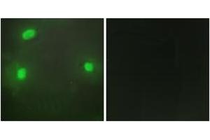 Immunofluorescence analysis of HeLa cells, using FEN1 Antibody. (FEN1 antibody  (AA 86-135))