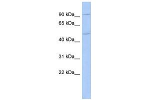 WB Suggested Anti-CXorf6 Antibody Titration:  0. (MAMLD1 antibody  (N-Term))