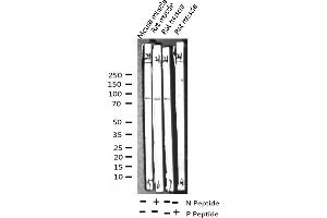 Western Blotting (WB) image for anti-Caldesmon 1 (CALD1) (pSer789) antibody (ABIN6255507)