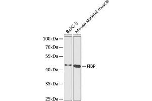Western blot analysis of extracts of various cell lines, using FIBP antibody  at 1:1000 dilution. (FIBP antibody  (AA 1-364))